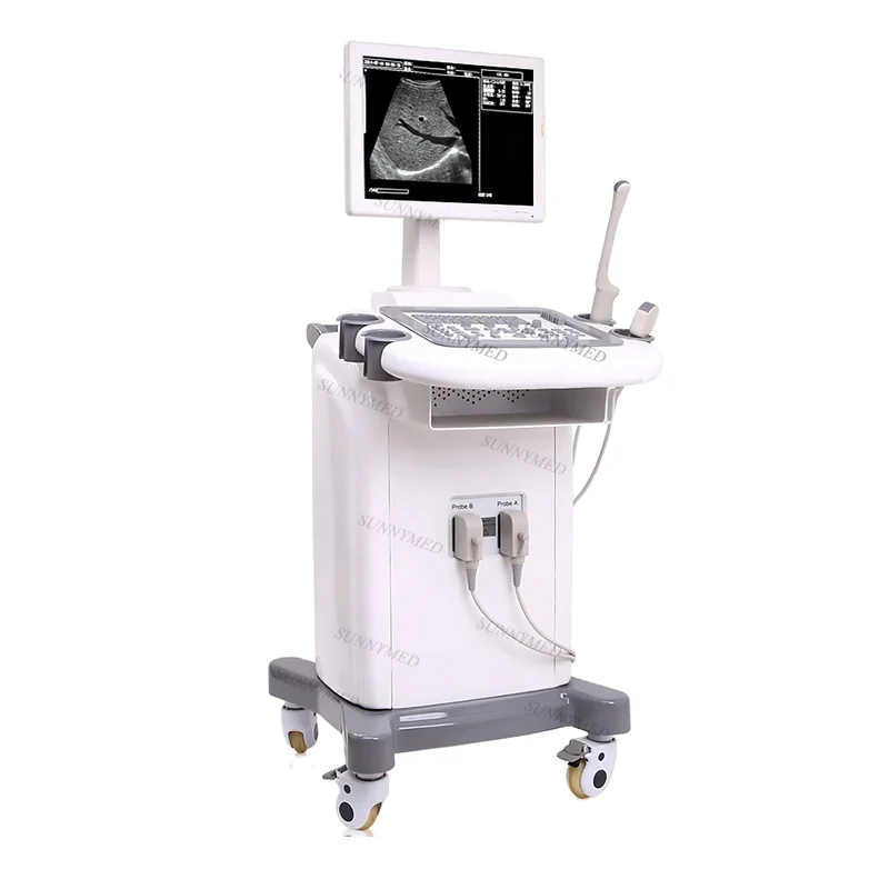 

SY-A020 Hospital Trolley Pregnancy Ultrasound B ultrasound with trolley