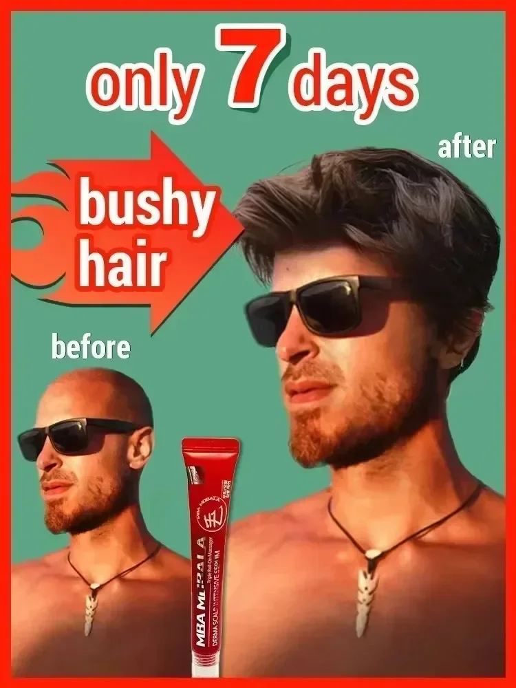 Сыворотка для быстрого роста волос восстановление облысения наследственный