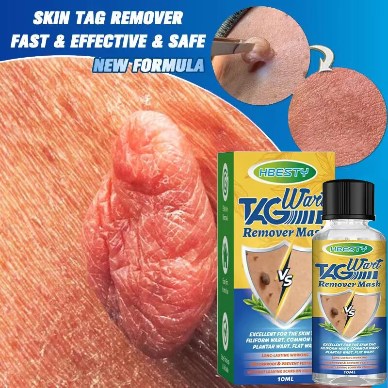 

Warts Remover Antibacterial Ointment Wart Treatment Cream Skin Tag Remover Genital Herpes Papillomas Treatment Ointment