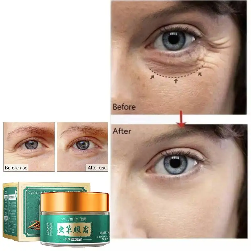 

Anti Wrinkle Eye Cream Anti Dark Circle Eye Bags Puffiness Lifting Firming Skin Care Eye Massage Anti Aging Tightening Puffiness