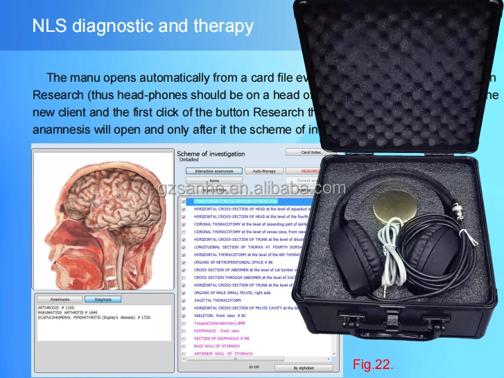 2024 Новый черный анализатор здоровья 9D NLS bioplasm nls