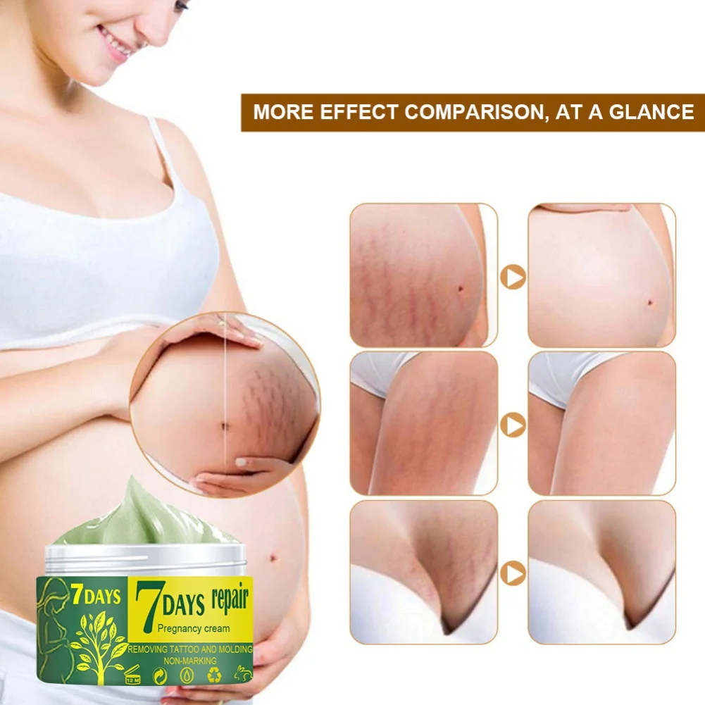 

10/30/50g Maternity Obesity Skin Postpartum Stretch Remover Smooth Skin Care Scar Body Marks Pregnancy Stretch Mark Repair Cream
