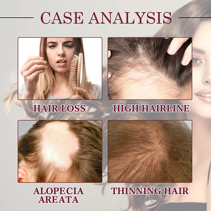 Масло для роста волос средство против выпадения эссенция восстановления и