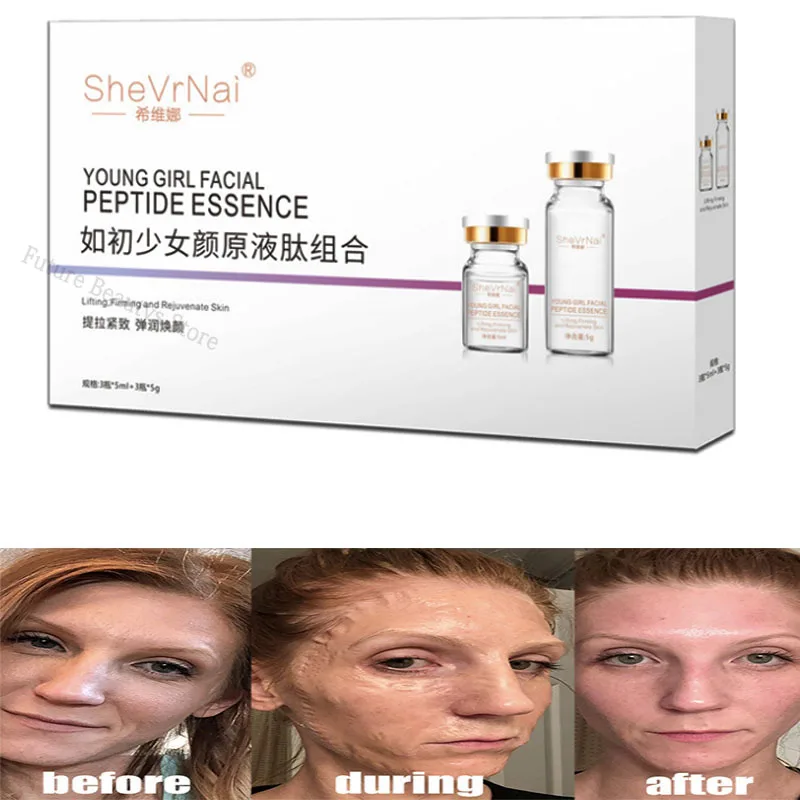 

Маска Hanacure Miracle, омолаживающая маска для лица для лифтинга и удаления морщин, увлажняющая маска для ухода за кожей