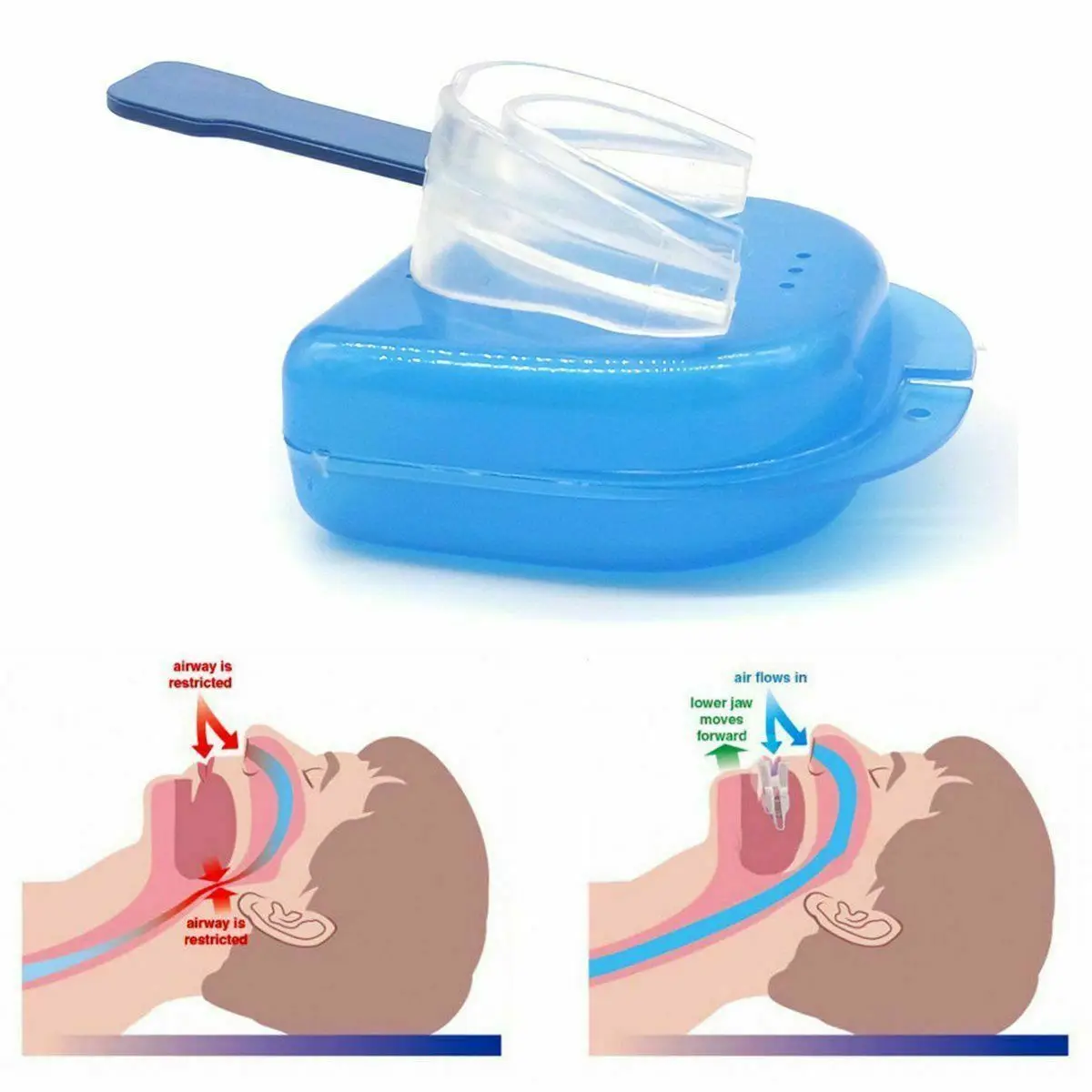

5* Dental Anti-snoring Stop Snoring Mouthpiece Tooth Cover Tray Brace Protector