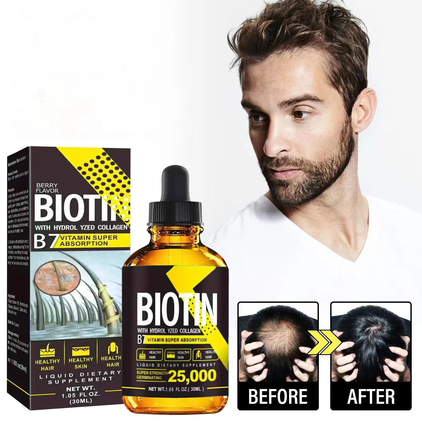 Эссенция для роста волос с витамином B7 против выпадения облысение быстрое