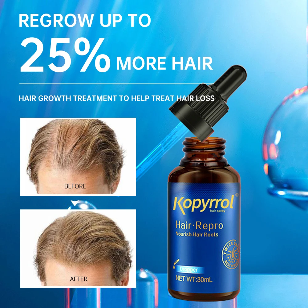 Продукция для роста волос эссенция быстрого масло предотвращения повреждения