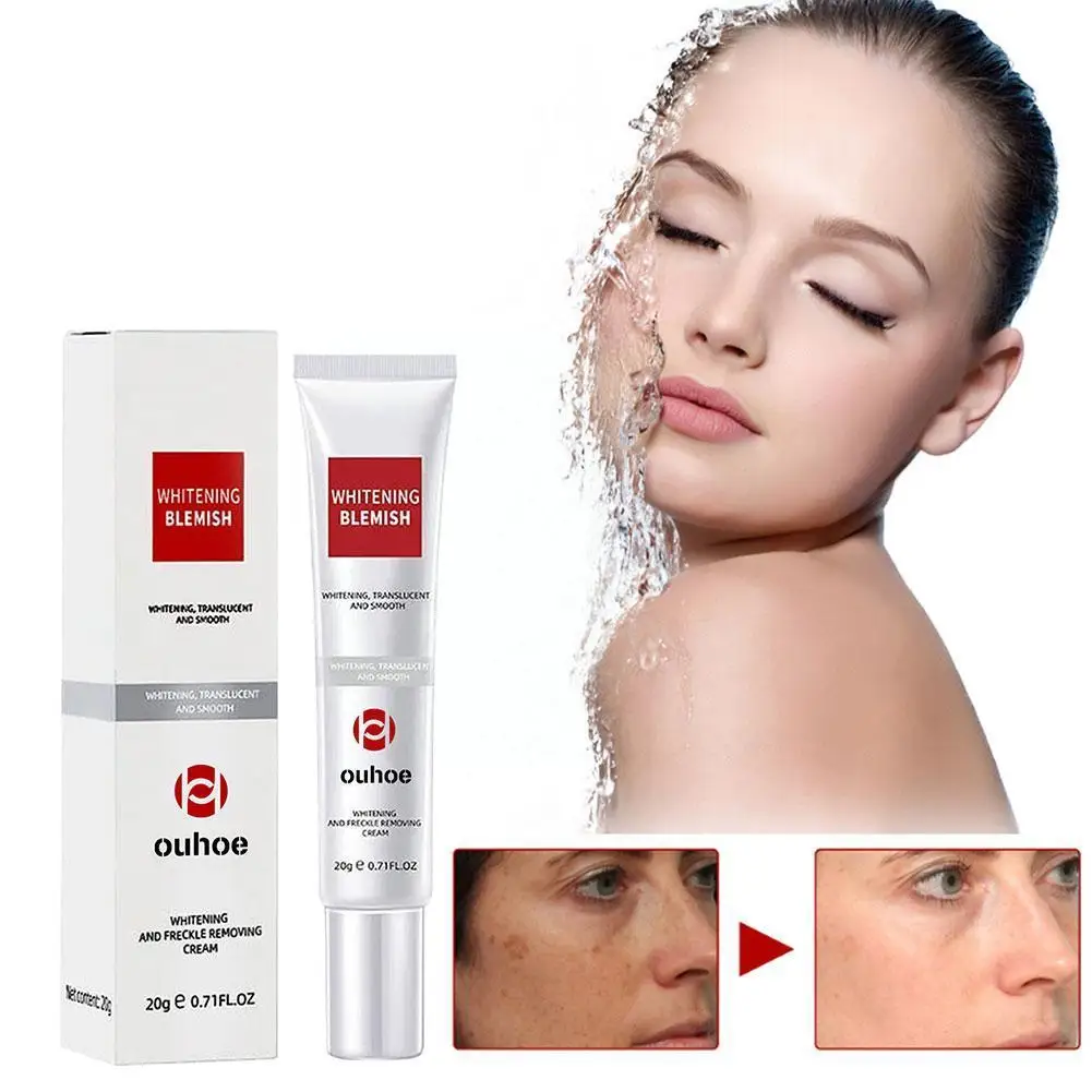 

Dark Spot Remover Cream Moisturize Brighten Smooth Melasma Moisturizing Skin Removal Care Korean Cream Face Face Anti Freck V6Z6