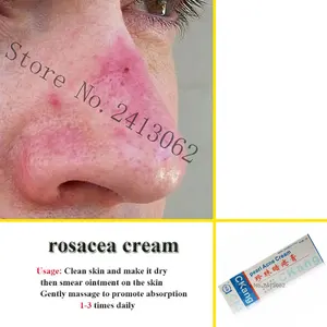 Rosacea Cream Red Nose Ointment Remove Blackhead Acne Cream Skin Care Herbal Anti Acne and Mite Acne