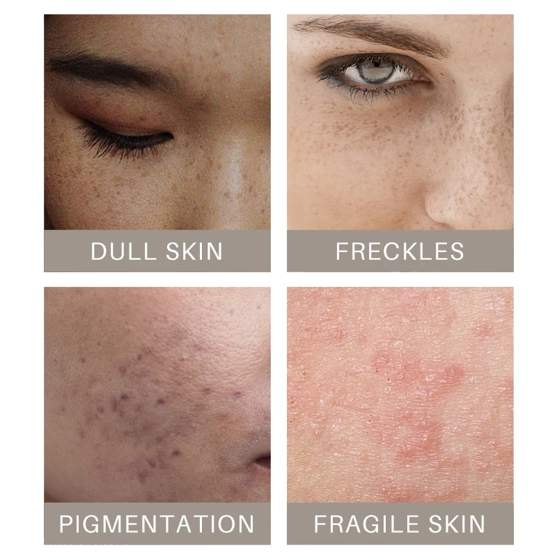 Маска для лица с витамином С куркума акне темные пятна удаление отшелушивающее