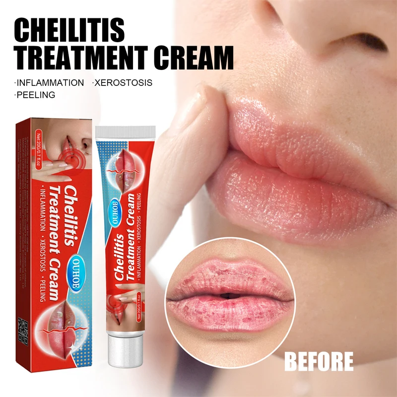 Lip Cream Reduce Fine Lines Remove Black Lips Reduce Pigmentation Volume Lip Plumper Serum Anti Drying Cracking Lip Repair Care