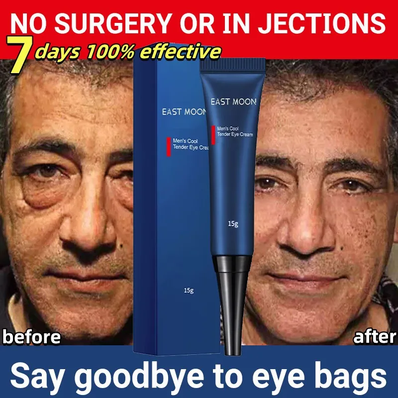Men's Retinol Eye Bags Removal Cream Anti Wrinkle Anti-aging Smooth Skin Cream Remove Dark Circle Puffiness Beauty Health Care
