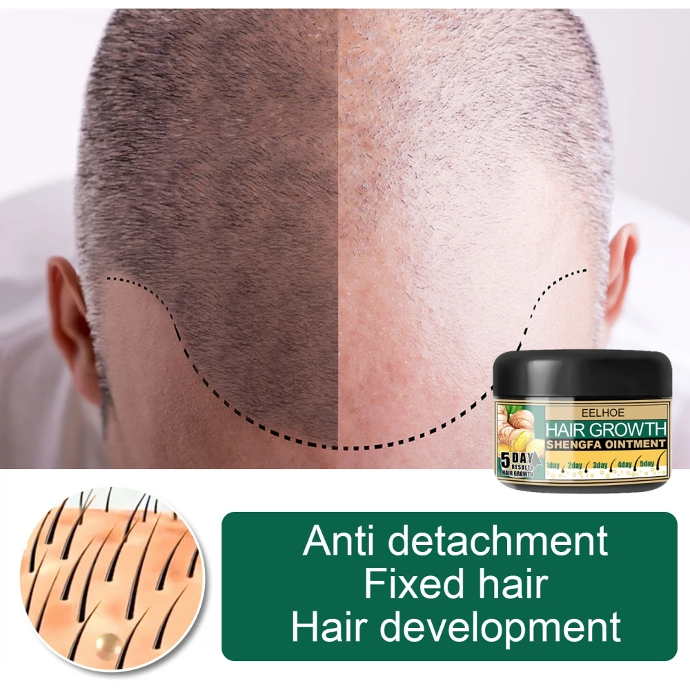 

30g Ginger Hair Growth Conditioner Anti-dandruff And Antipruritic Moisturizing Scalp Massage Cream To Stimulate Hair Follicle