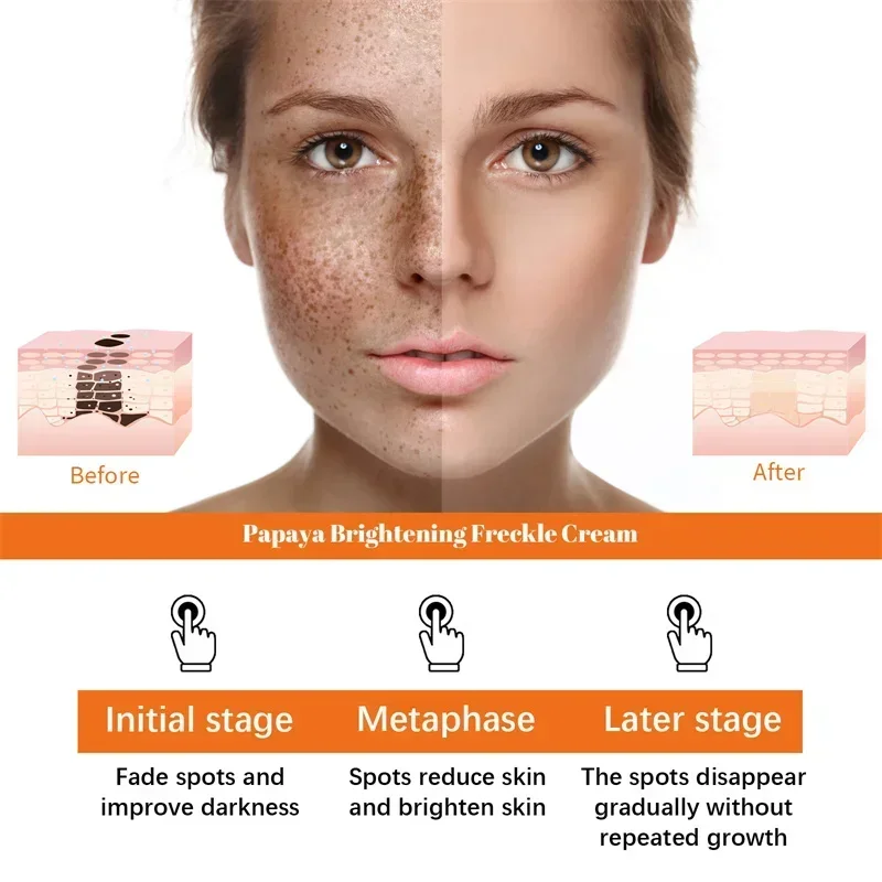 Увлажняющий отбеливающий крем для кожи коррекция темных точек