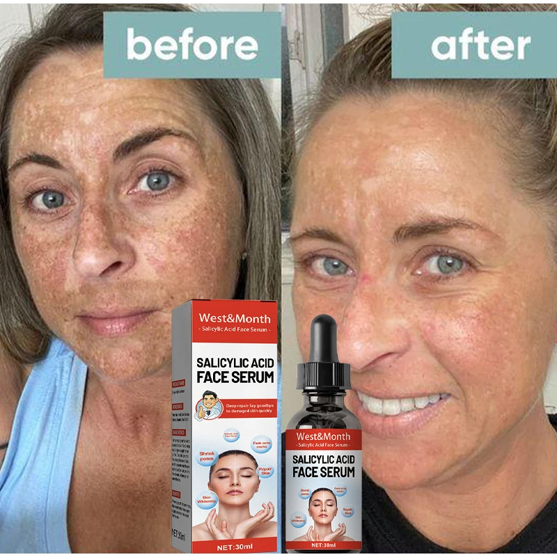 Niacinamide сыворотка с гиалуроновой кислотой для лица