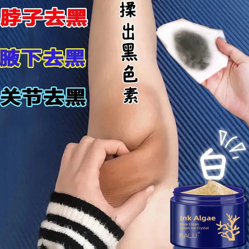 1pcs Body Whitening Cream Private Parts Underarm Bleaching Serum Remove Melanin Pigmentation Brighten Inner Thigh Intimate Dark