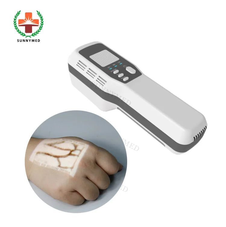 

SY-G088 Medical Vein Illuminators vein viewer price best vein viewing