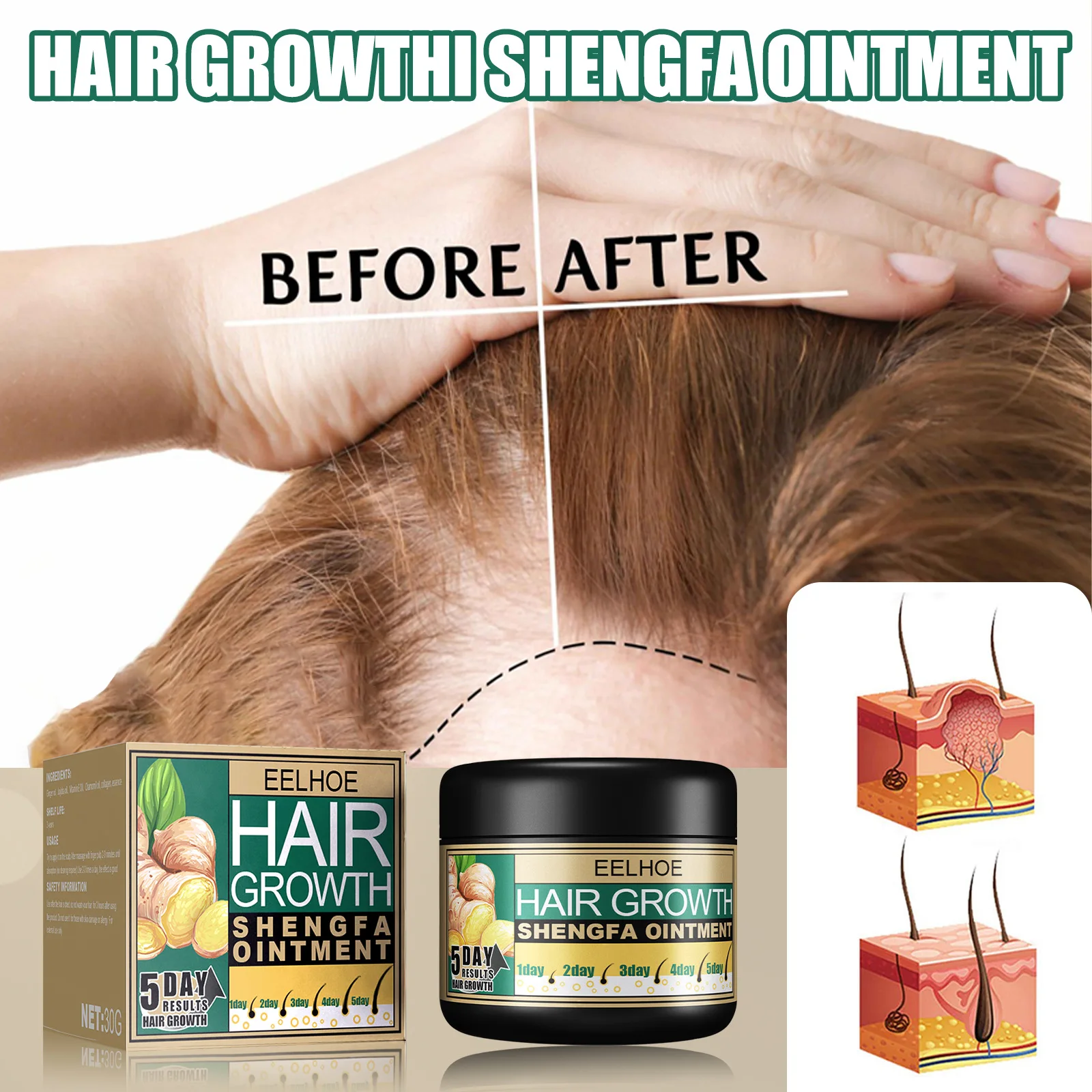 

Ginger Hair Loss Treatment Hair Growth Cream Effective Fast Thick Dense Natural Hair Care Massage Hair Loss Prevention Products