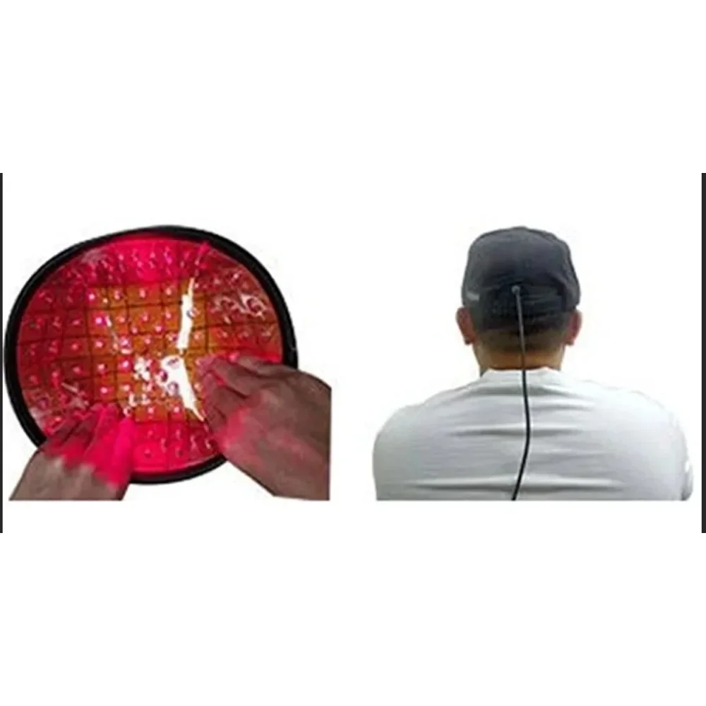 Лазерный шлем для роста волос светодиодная шапочка решение против выпадения