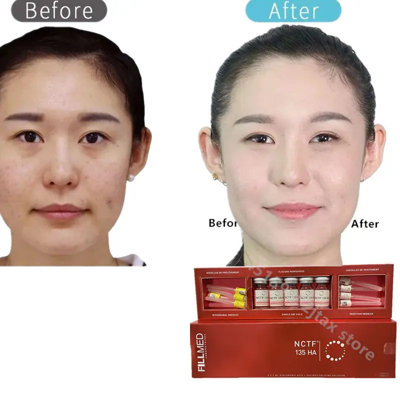 

2023 new Mesotherapy Fillmed NCTF 135HA Anti-Wrinkle Increase Collagen Production Restore Skin Collagen Solution 5*3ml