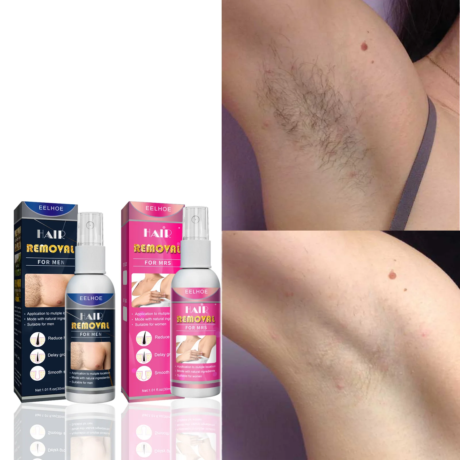 

10ml/20ml/30ml/50ml Hair Removal Spray Hair Growth Inhibitor Natural Painless Permanent Depilatory Cream Skin Care Product