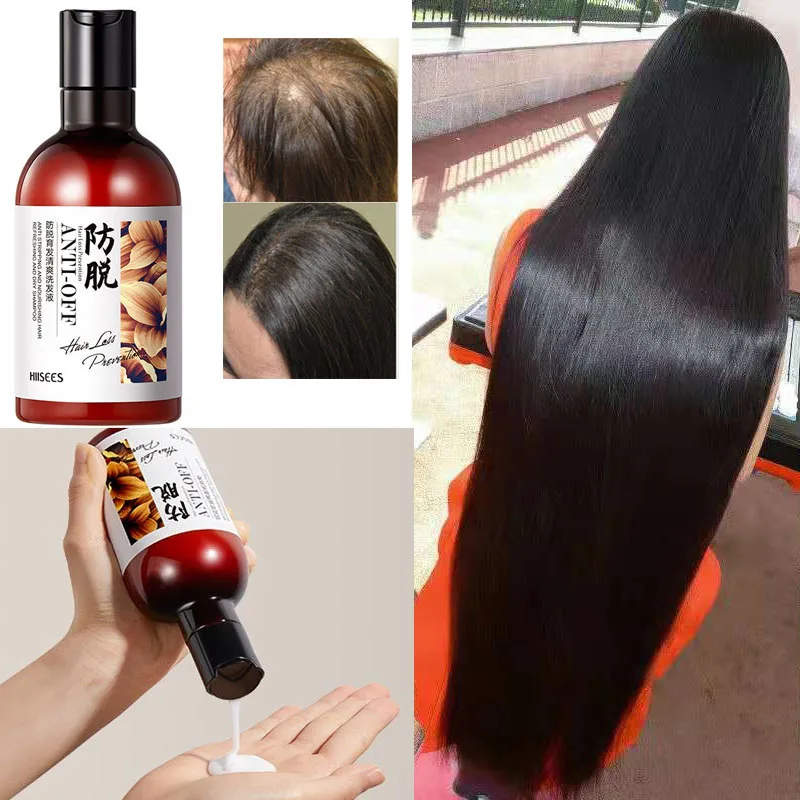 

250ml Hair Care Product Ginger Anti Hair Loss Hair Growth Serum Shampoo Effective Hair Loss Treatment Cool Hair Growth Liquid