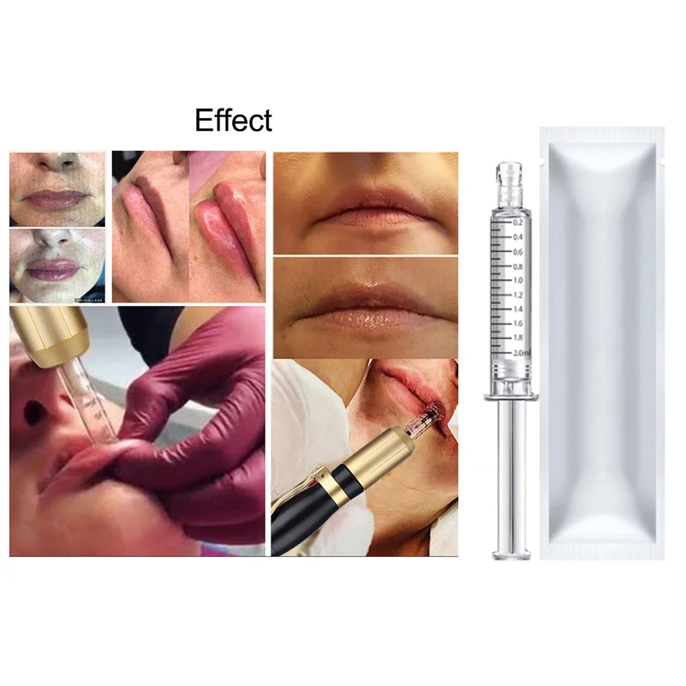 

2ml Hyaluronic Acid Serum Lip/Nose/Cheek Hyaluronic Acid Crosslinked HA Lips Enhancement for Pen Remove Wrinkles Kroea