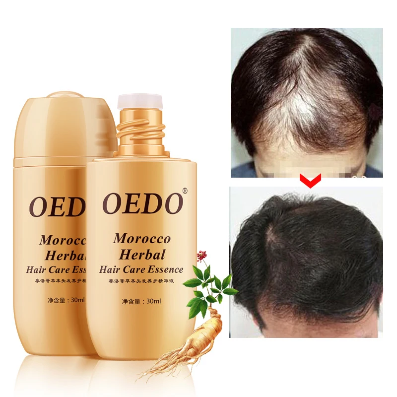 

Марокканский травяной женьшень для ухода за волосами эссенция для мужчин и женщин Мужская выпадение волос быстрая мощная Сыворотка для рос...