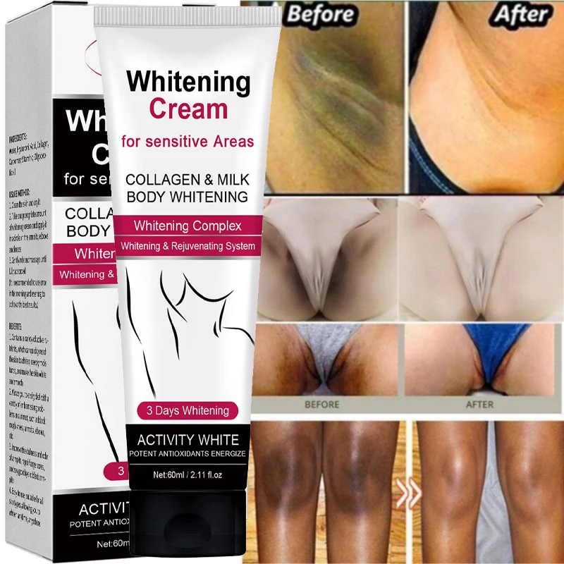 

Vitamin C Body Whitening Cream Armpit Knee Elbow Private Parts Bleach Fade Melanin Pigmentation Improve Dull Brighten Skin Care