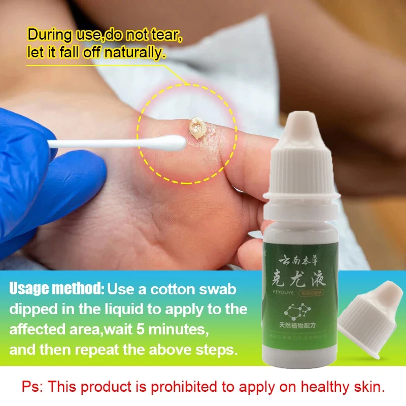 

2pcs 10ml Wart Liquid Papillomas Removal Genital Warts Liquid From Skin Tags Removing Against Moles Body Repair Dressing