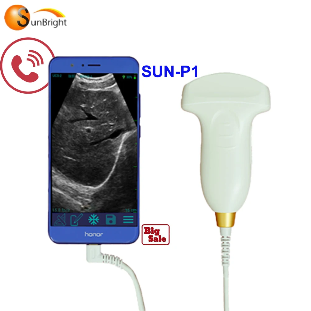 

Digital Ultrasonic Diagnostic System USB Convex Probe SUN-P1