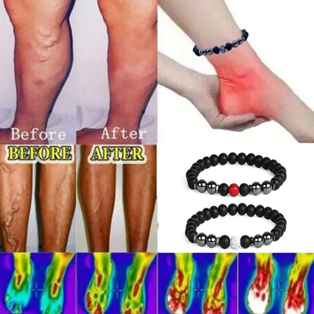 

8mm Unisex Obsidian Anklet Adjustable Weight Loss Magnetic Therapy Magnet Anklet Bracelet