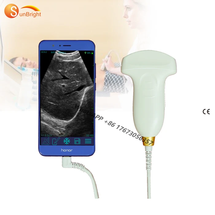 

Cheapest Portable USB Convex Scanner Ultrasound Probe