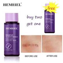 Acne Scar Removal Essential Oil Repair Skin Care Product Whitening Moisturizing Strentch Marks Remov