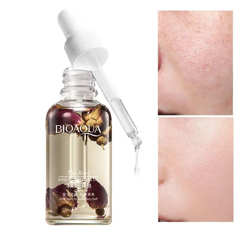 

Hydrating Essential Oils 1.05 Fl Oz Skin Care Essential Oil Aromatherapy Oil Rose Stem Flower Oil Essential Oil For Massage Skin