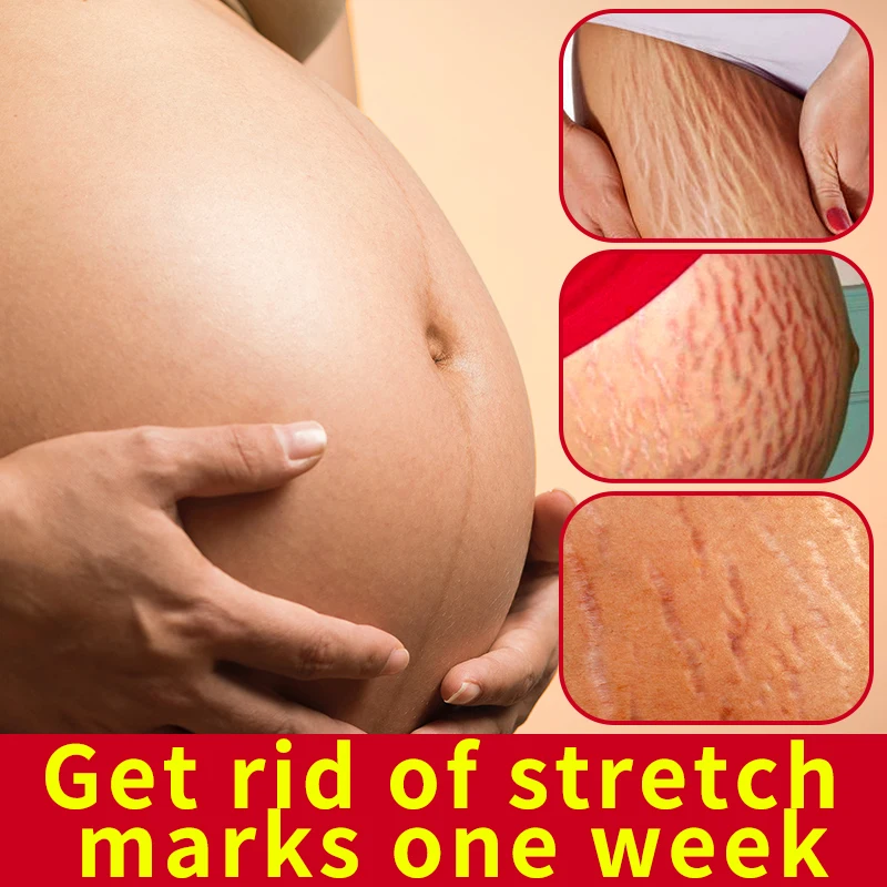 Масло для предотвращения растяжек при беременности (30 мл) | Гипоаллергенное и без