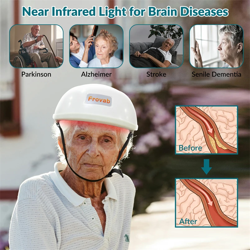 Длина волны 1070 нм Терапия красным светом Лечение заболеваний Паркинсона боли