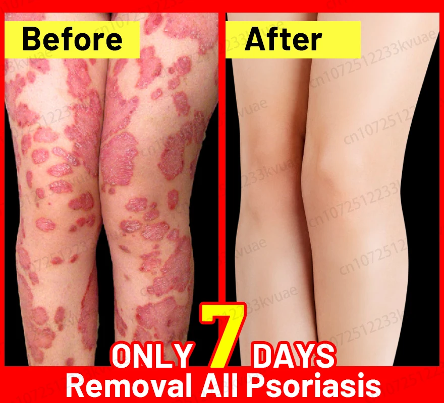 Быстро очищает кожу и восстанавливает ее здоровый гладкий