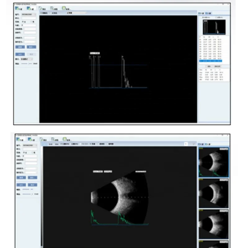 Офтальмологические ультразвуковые A/ B Pachymeter Scan портативный офтальмологический