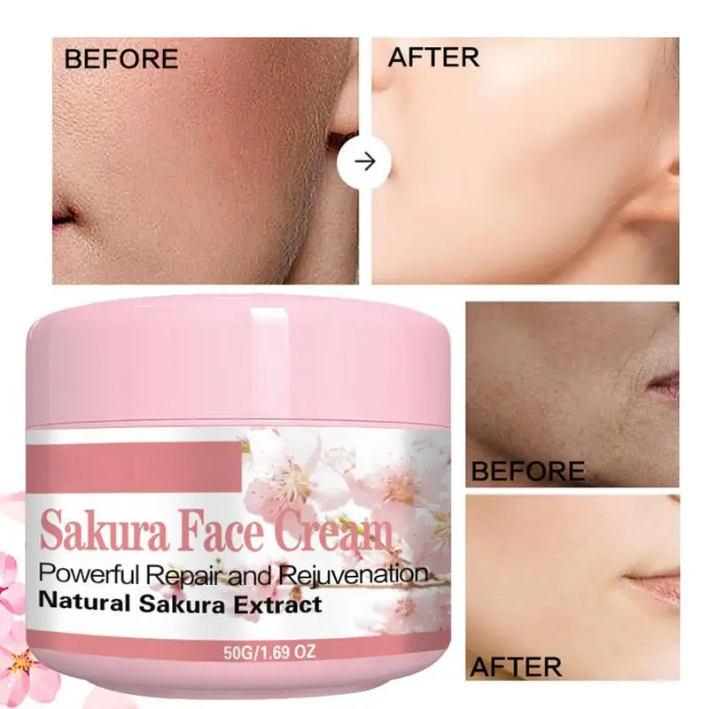

Face Whitening Freckle Cream Moisturiser Anti Aging Beauty Skin Care Facial Cream Moisturizing Acne Marks Brightening Skin Care