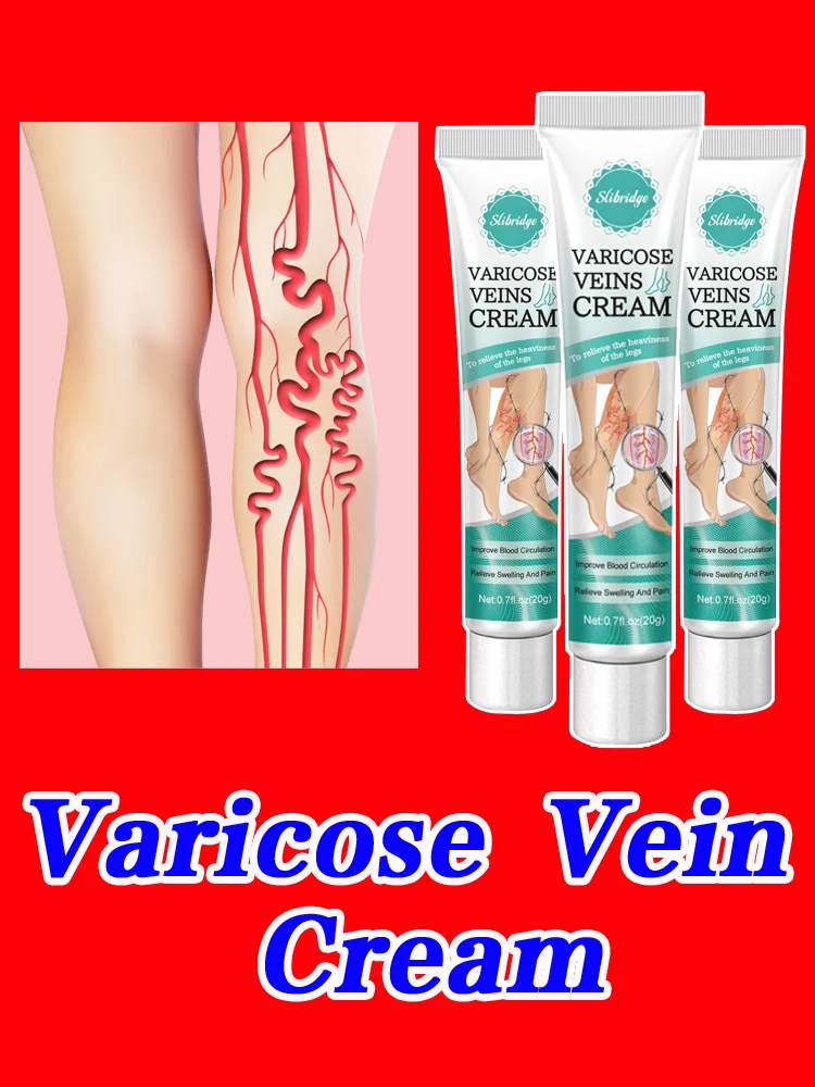 Помада для veias varicosas alivia Fiskmente как и vasculite flebite