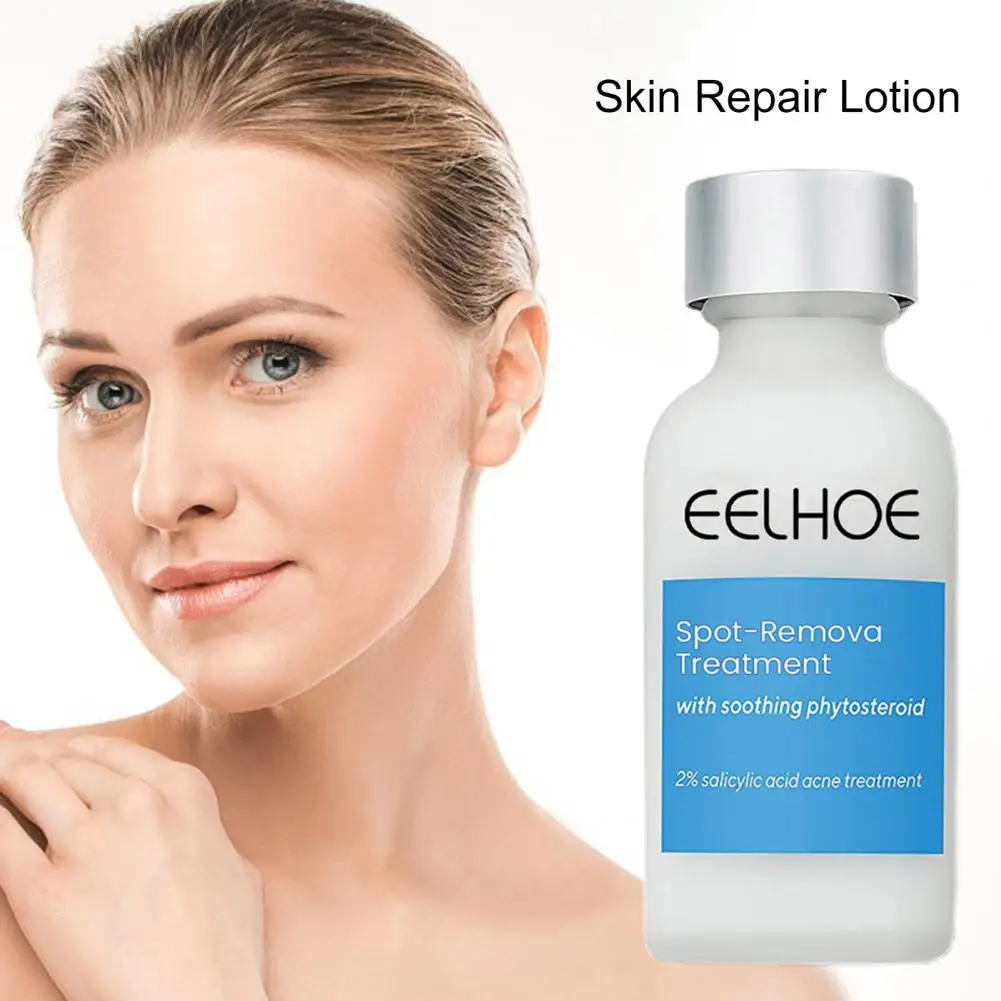 

Омолаживающий крем практичный эффективный 30 мл омолаживающий крем для веснушек уход за кожей для женщин