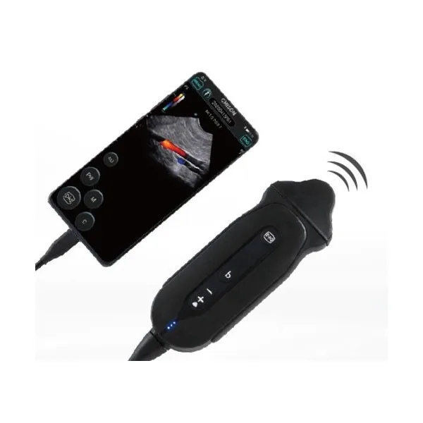 

Ultrasound Chison SonoEye P6 Portable Cardiac Micro-Convex Probe for Ultrasound Scanning