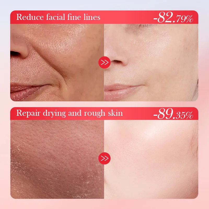 Тоник WolfBerryes для лица эссенция Годжи увлажняющая против морщин ягода укрепляющий