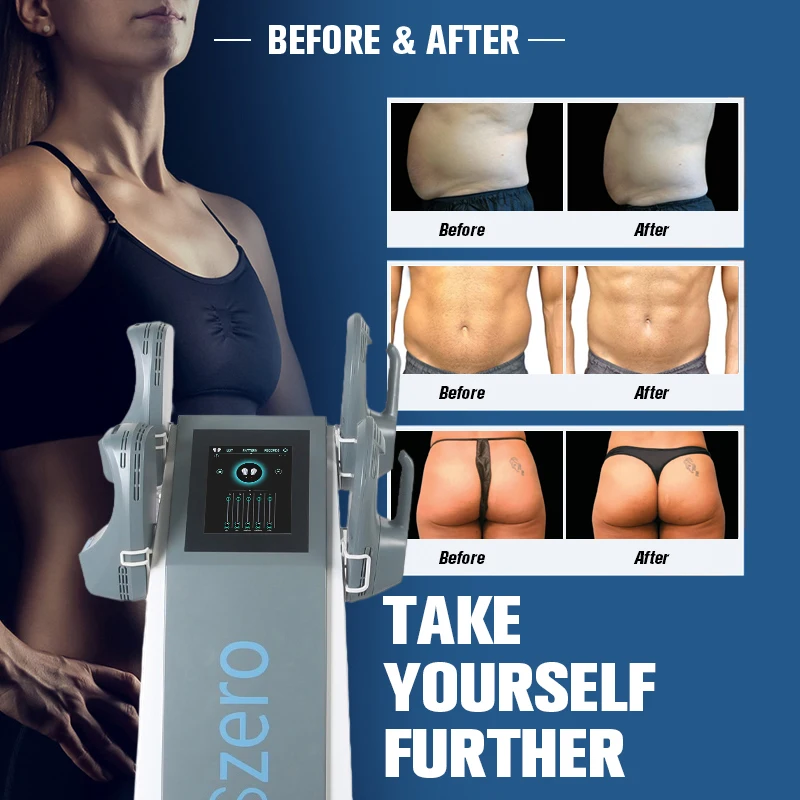 

2022 DLS-EMSLIM Weight Lose Body Device Slimming Muscle Stimulate Body Slimming Build Muscle Emszero Machine 4 Connector