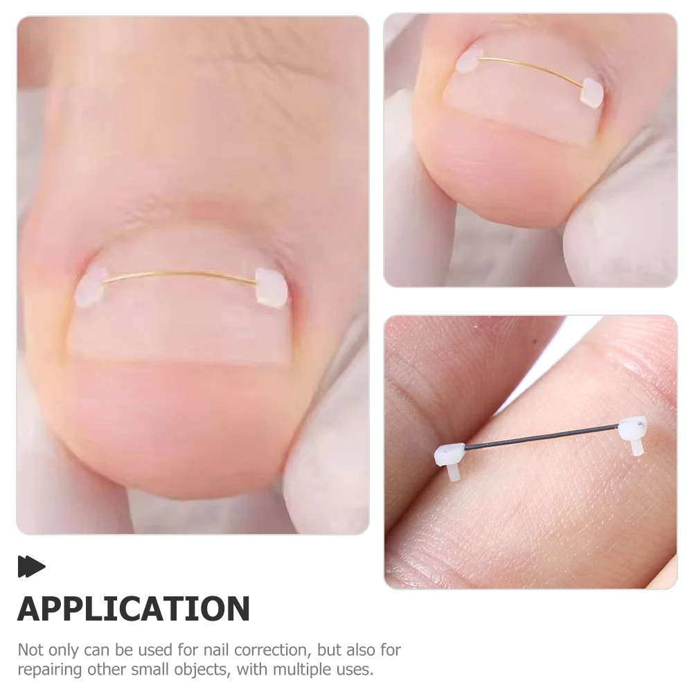 

6 Pcs Toenail Tool Stainless Steel Correction Wire Tools Convenient Titanium Alloy Professional Compact Household Corrector