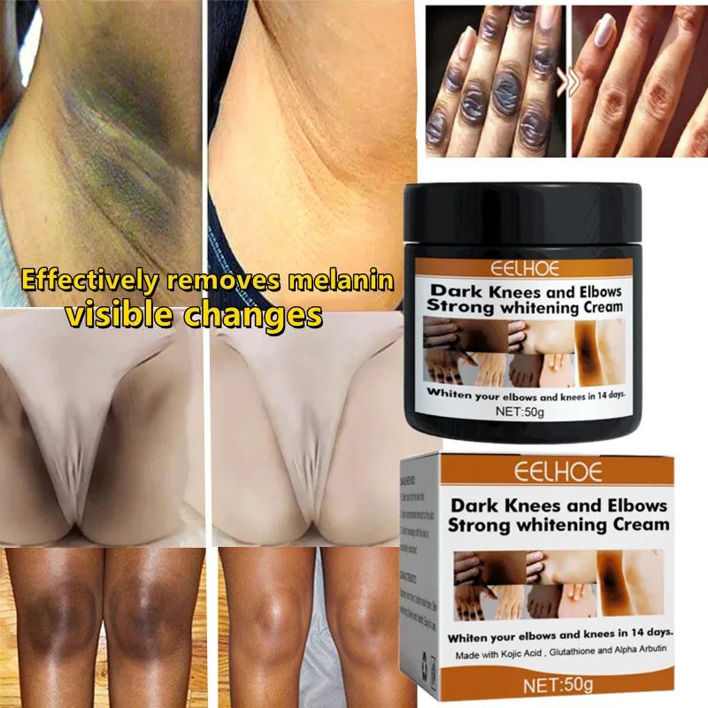 

Отбеливающий крем для суставов, быстрое Отбеливание тела, частные части, лицо, подмышки, колени, ноги, меланин, частные части, отбеливающий крем