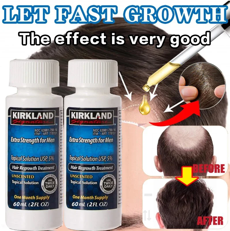 

Hair Tonic MlN 0 XlDlL Fast Hair Growth Essence Spray Hair Growth Serum Nourishing Soften Treatment Hair Hair Growth Liquid