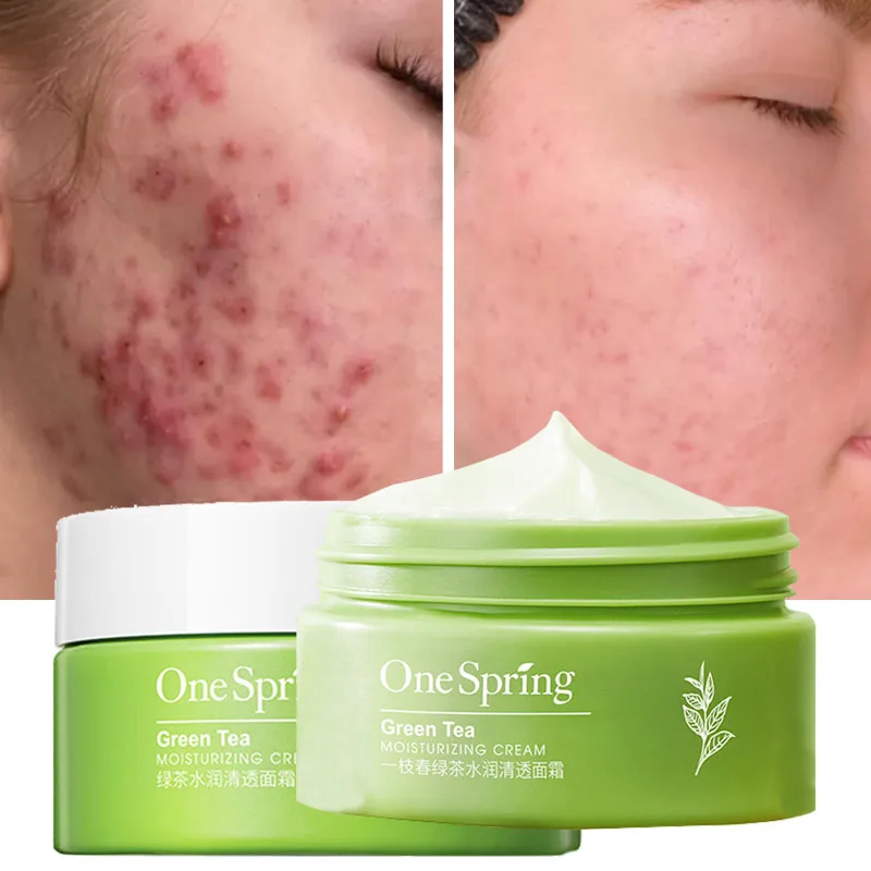 

Green Tea Acne Removal Cream Acne Treatment Pore Shrinking Facial Cream Remove Blackheads Acne Scars Redness Whitening Skin Care