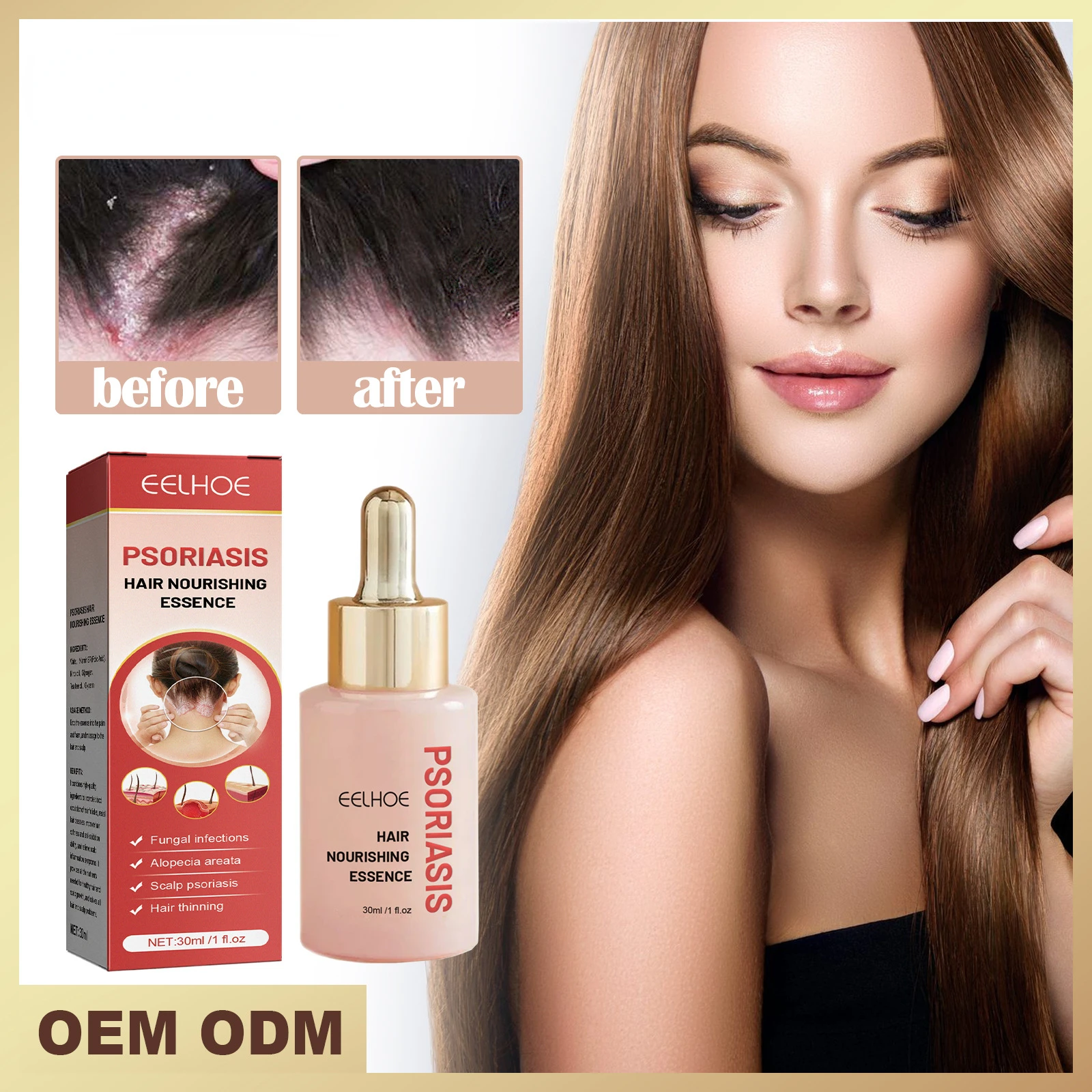 

Psoriasis Dandruff Treatment for Scalp Oil Anti Itching Follicle Booster Stimulator Moisturizes Smoothing Nourishing Hair Serum